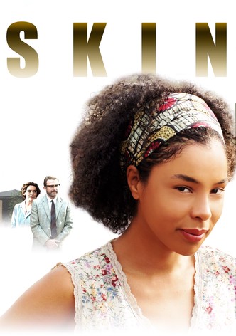 Skin-poster-2009-1768732145